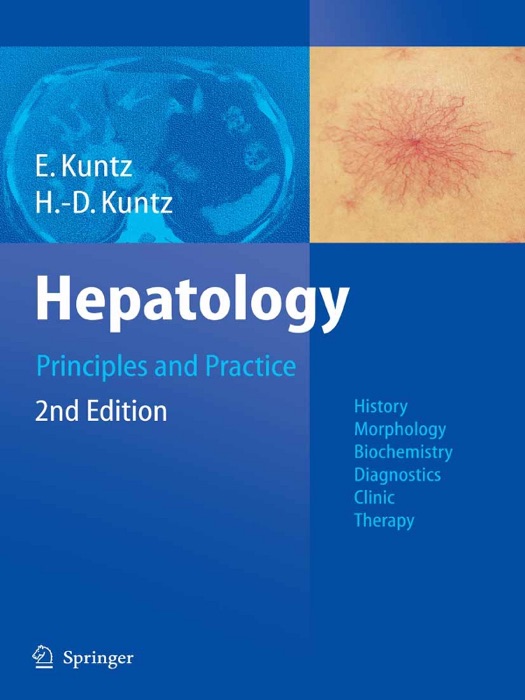 Hepatology, Principles and Practice