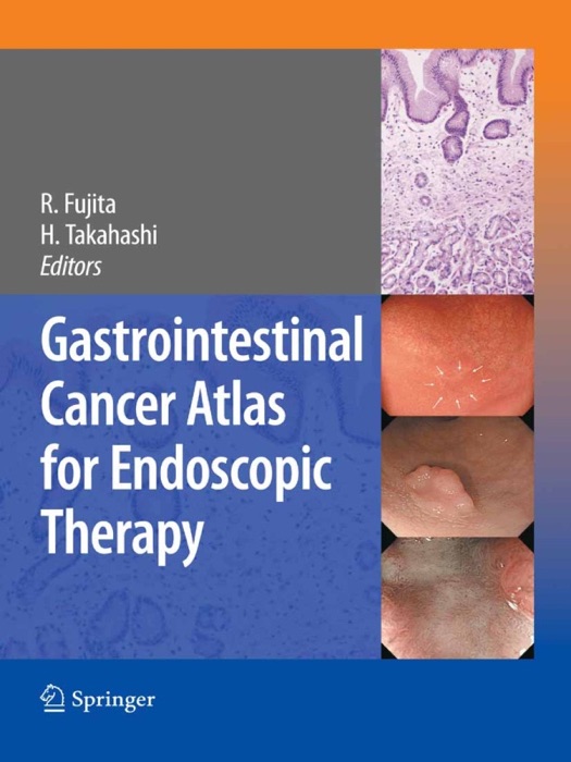 Gastrointestinal Cancer Atlas for Endoscopic Therapy