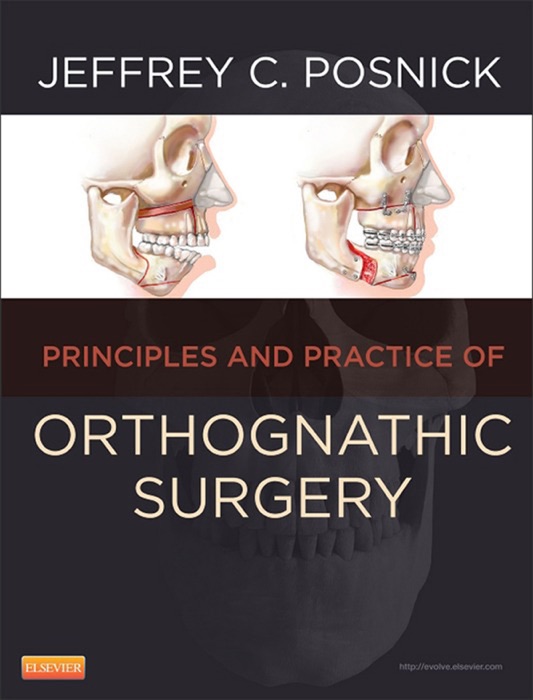 Orthognathic Surgery - E-Book