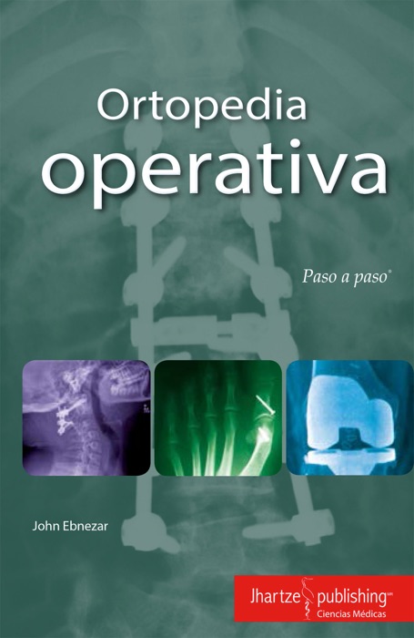 ORTOPEDIA OPERATIVA