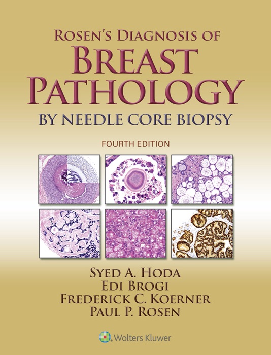 Rosen’s Diagnosis of Breast Pathology by Needle Core Biopsy