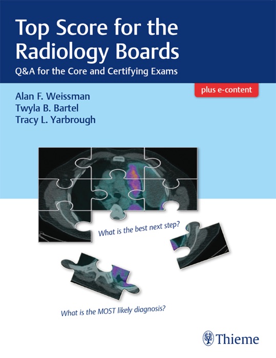 Top Score for the Radiology Boards