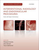 Challenging Concepts in Interventional Radiology - Miltiadis Krokidis, Irfan Ahmed & Tarun Sabharwal