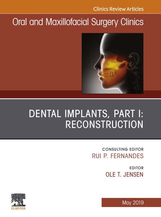 Dental Implants, Part I: Reconstruction, An Issue of Oral and Maxillofacial Surgery Clinics of North America, Ebook