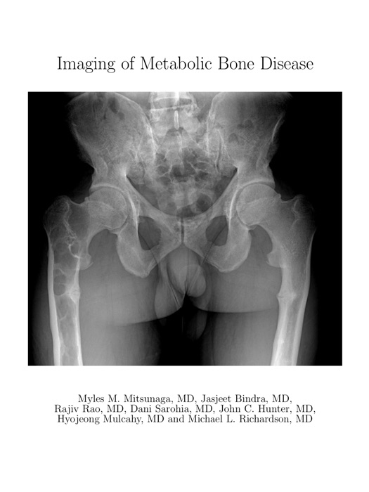 Imaging of Metabolic Bone Disease