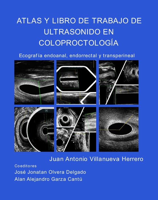 Atlas y Libro de Trabajo de Ultrasonido en Coloproctología