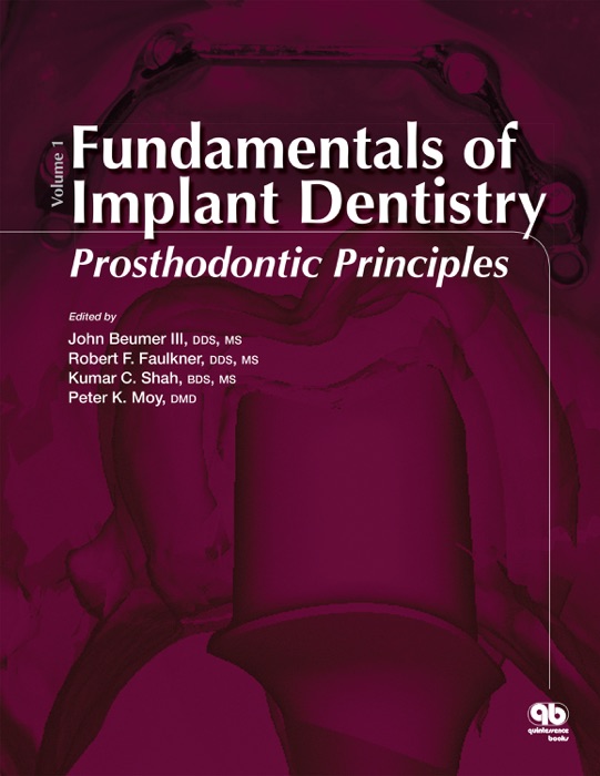 Fundamentals of Implant Dentistry, Volume 1