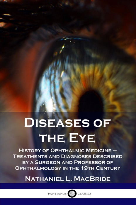 Diseases of the Eye