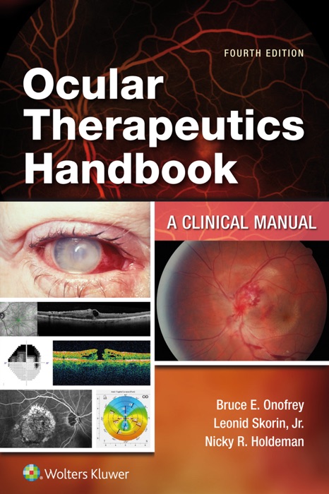 Ocular Therapeutics Handbook