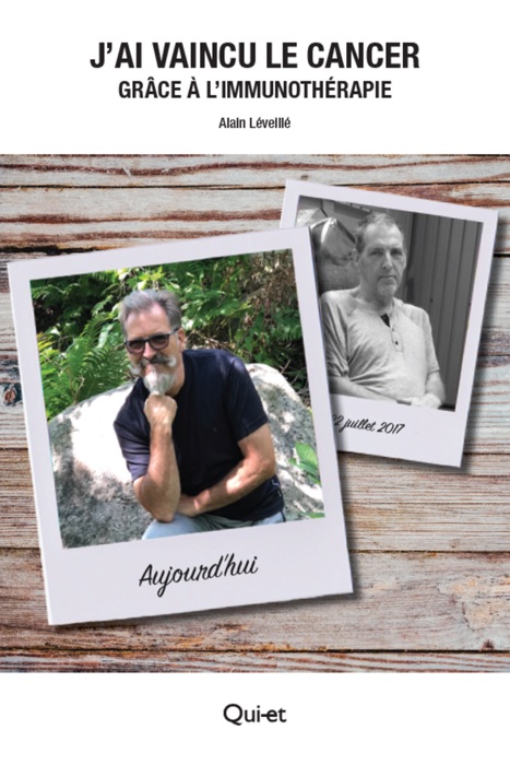 J'ai vaincu le cancer grâce à l'immunothérapie