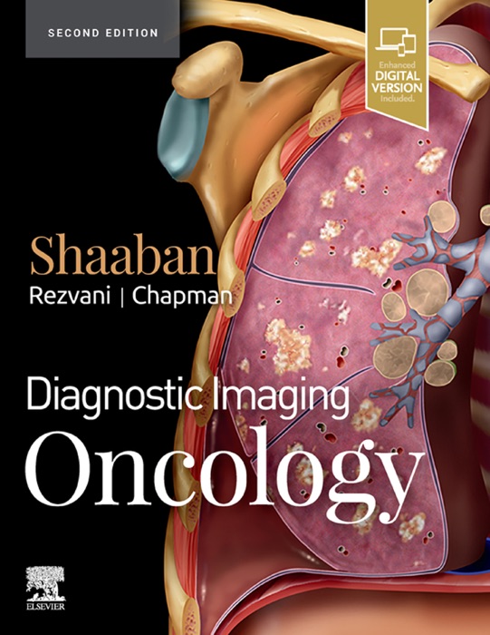 Diagnostic Imaging: Oncology E-Book