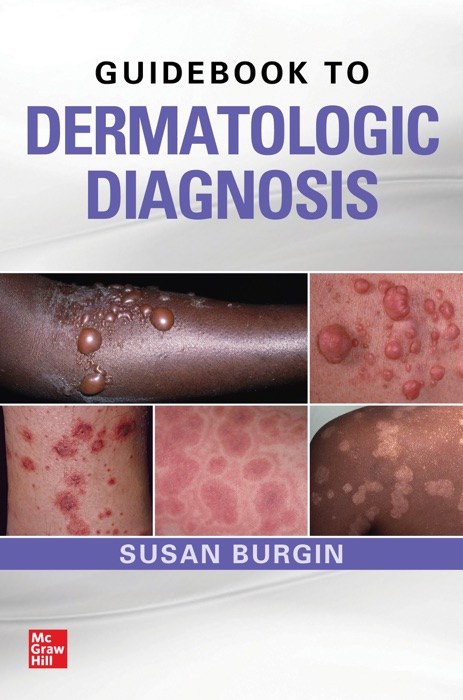 Guidebook to Dermatologic Diagnosis