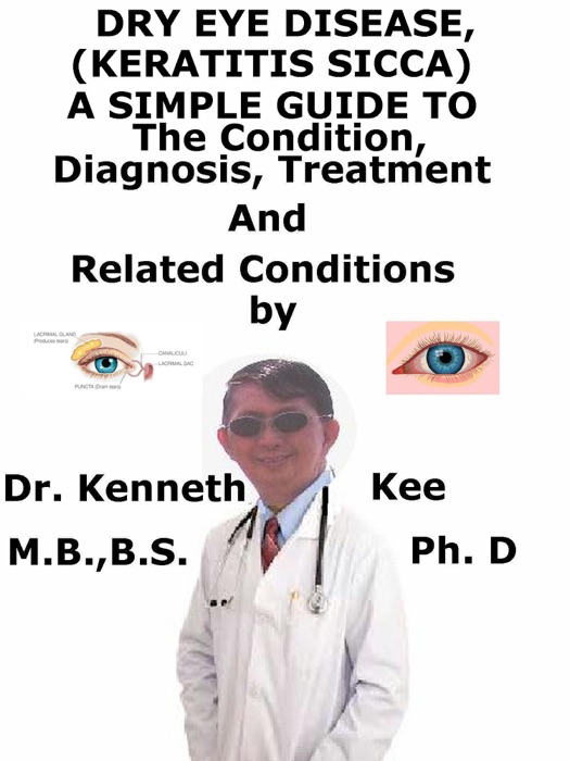 Dry Eye Disease, (Keratitis Sicca) A Simple Guide To The Condition, Diagnosis, Treatment And Related Conditions