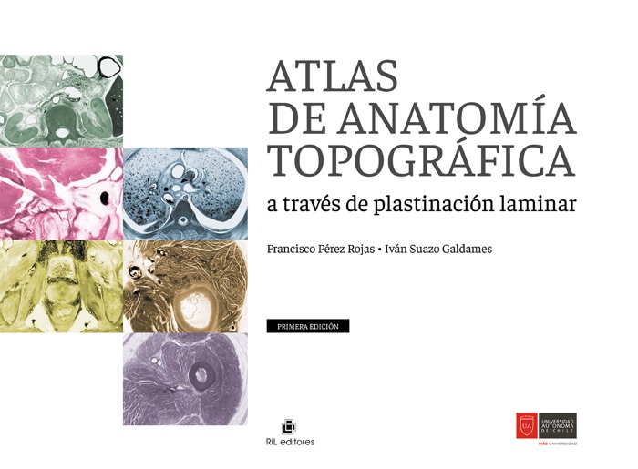 ATLAS DE ANATOMÍA TOPOGRÁFICA A TRAVÉS DE PLASTINACIÓN LAMINAR