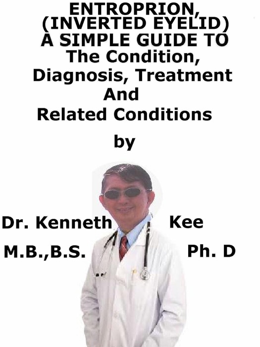 Entropion, (Inverted Eyelid) A Simple Guide To The Condition, Diagnosis, Treatment And Related Conditions