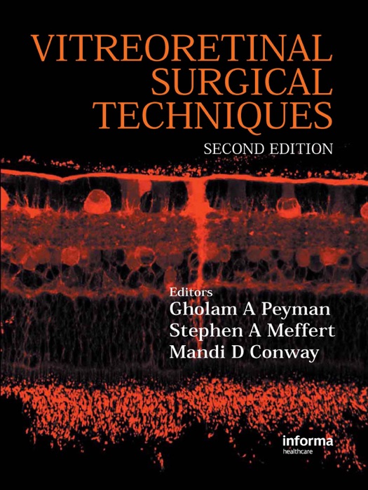 Vitreoretinal Surgical Techniques, Second Edition