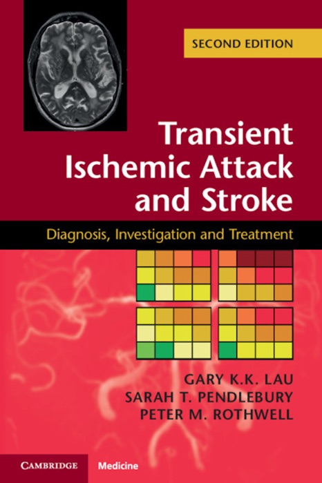 Transient Ischemic Attack and Stroke: Second Edition