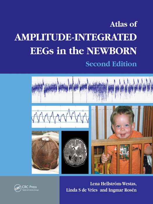 An Atlas of Amplitude-Integrated EEGs in the Newborn