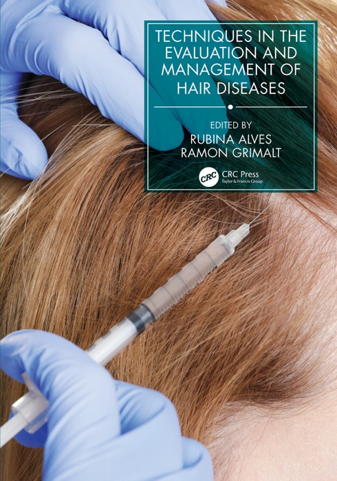 Techniques in the Evaluation and Management of Hair Diseases