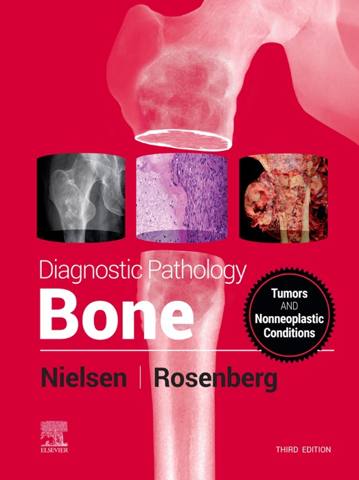 Diagnostic Pathology: Bone