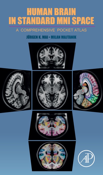 Human Brain in Standard MNI Space