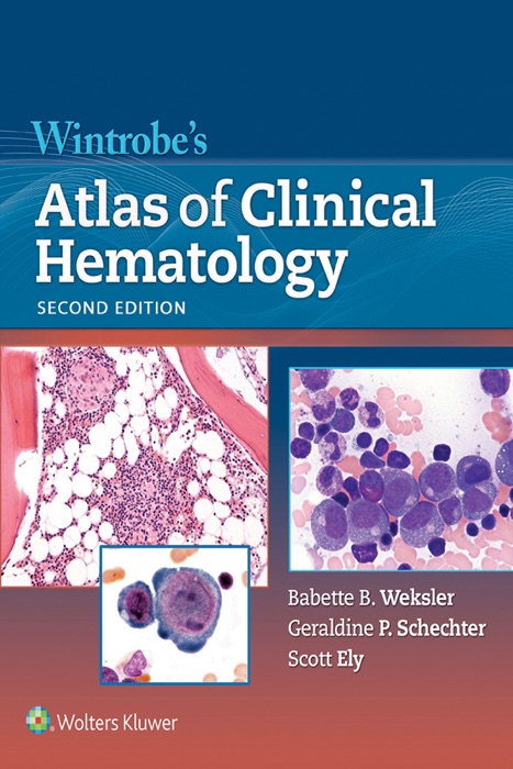 Wintrobe’s Atlas of Clinical Hematology