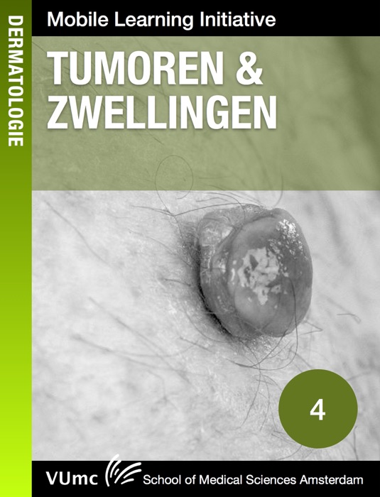 Tumoren & zwellingen