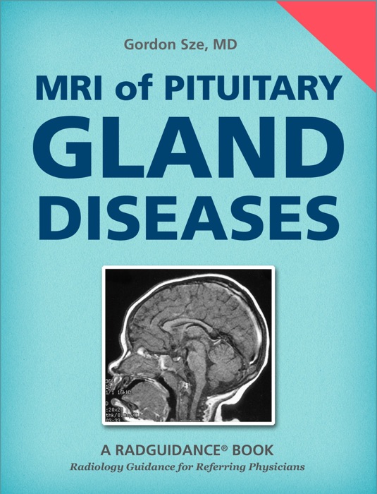 MRI of Pituitary Gland Diseases