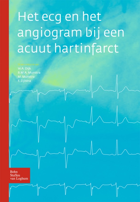 Het ecg en het angiogram bij een acuut hartinfarct