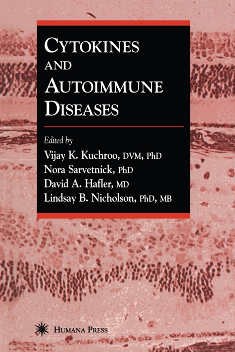 Cytokines and Autoimmune Diseases