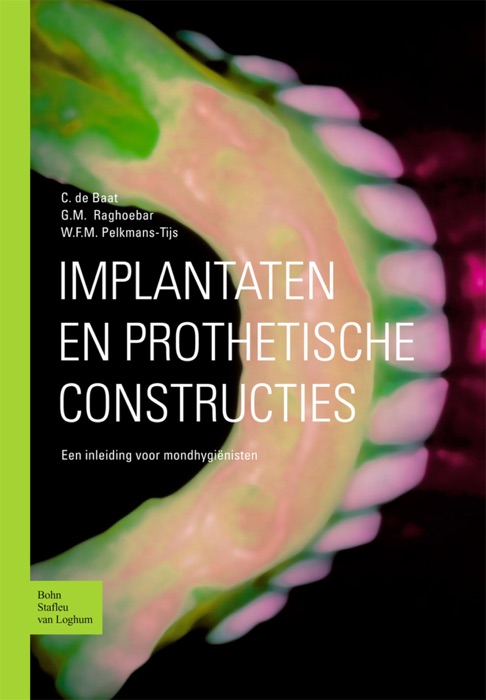 Implantaten en prothetische constructies