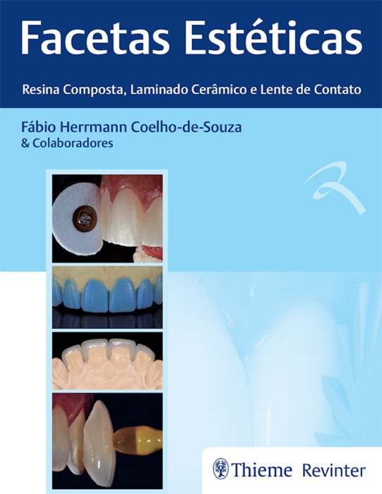 Facetas Estéticas – Resina Composta, Laminado Cerâmico e Lente de Contato