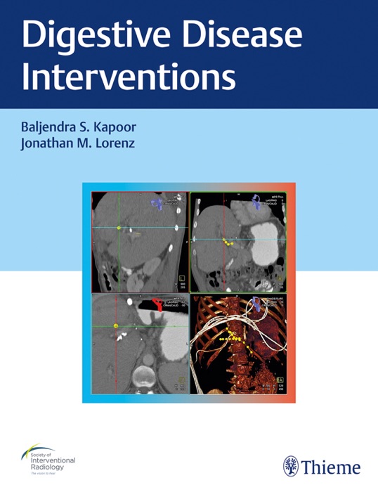 Digestive Disease Interventions