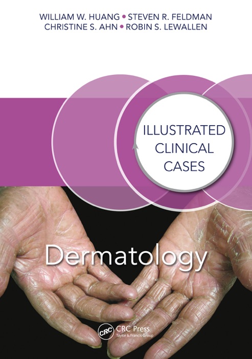 Dermatology