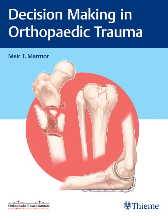 Decision Making in Orthopaedic Trauma