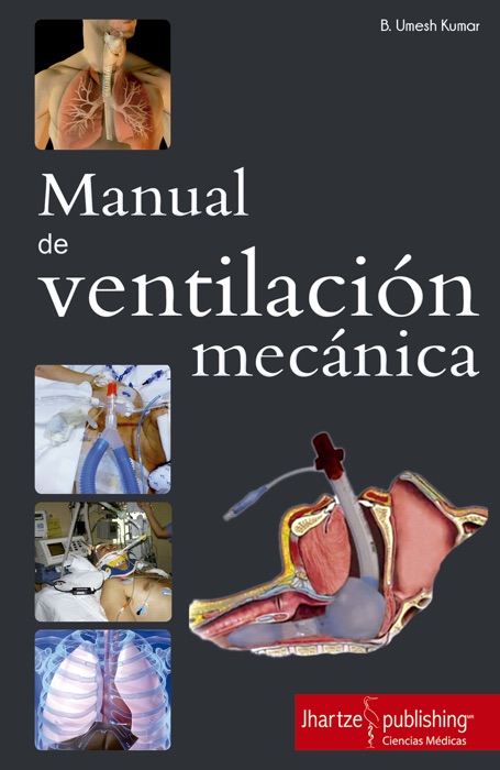 MANUAL DE VENTILACIÓN MECÁNICA