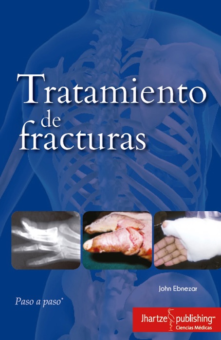 TRATAMIENTO DE FRACTURAS