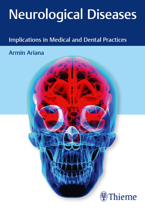 Neurological Diseases