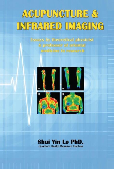 Acupuncture and Infrared Imaging