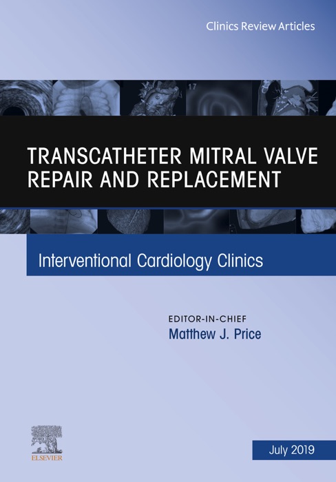 Transcatheter mitral valve repair and replacement, An Issue of Interventional Cardiology Clinics, Ebook