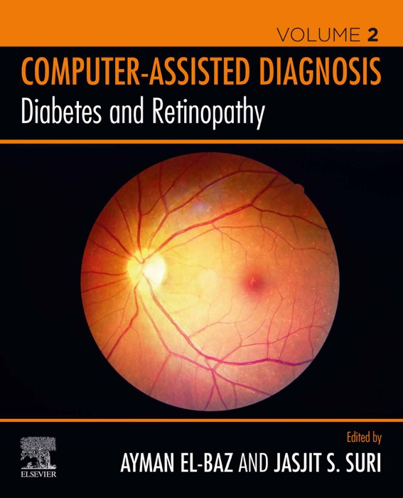 Diabetes and Retinopathy (Enhanced Edition)