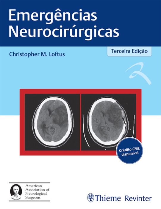 Emergências Neurocirúrgicas