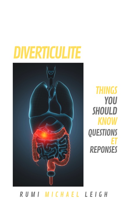 Diverticulite