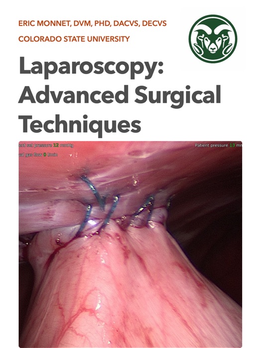 Laparoscopy: Advanced Surgical Procedures