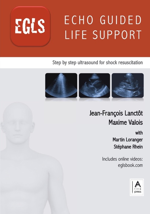 Echo Guided Life Support (EGLS)