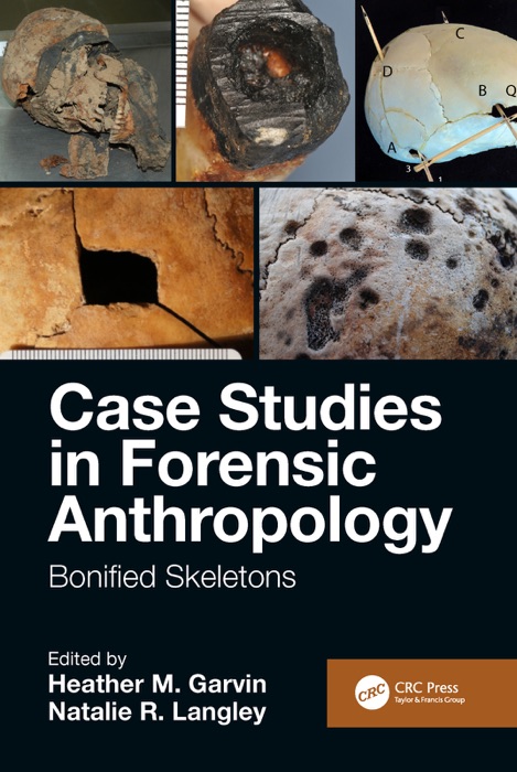 Case Studies in Forensic Anthropology