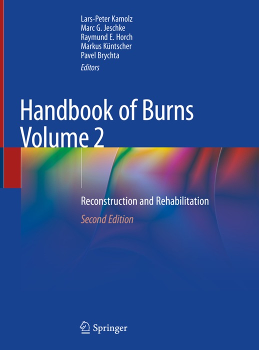 Handbook of Burns Volume 2