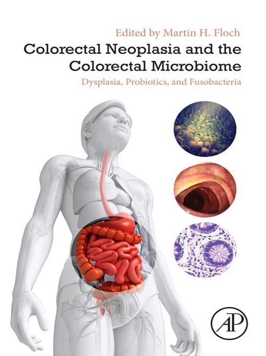 Colorectal Neoplasia and the Colorectal Microbiome