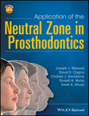 Application of the Neutral Zone in Prosthodontics - Joseph J. Massad, David R. Cagna, Charles J. Goodacre, Russell A. Wicks & Swati A. Ahuja