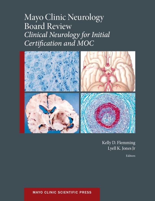 Mayo Clinic Neurology Board Review: Clinical Neurology for Initial Certification and MOC